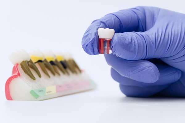 Does Dental Insurance Cover Dental Crowns?